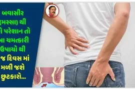બવાસીર (મસ્સા) થી છો પરેશાન તો આ ચમત્કારી ઉપાયો થી 7 જ દિવસ માં મળી જશે ચૂંટકરો…